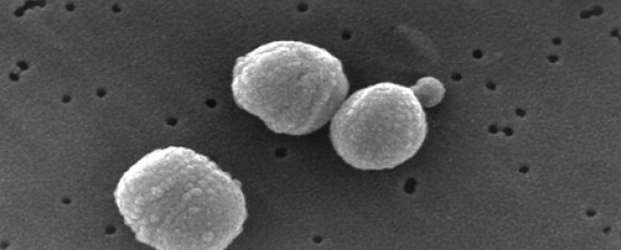 Streptococcus-pneumoniae
